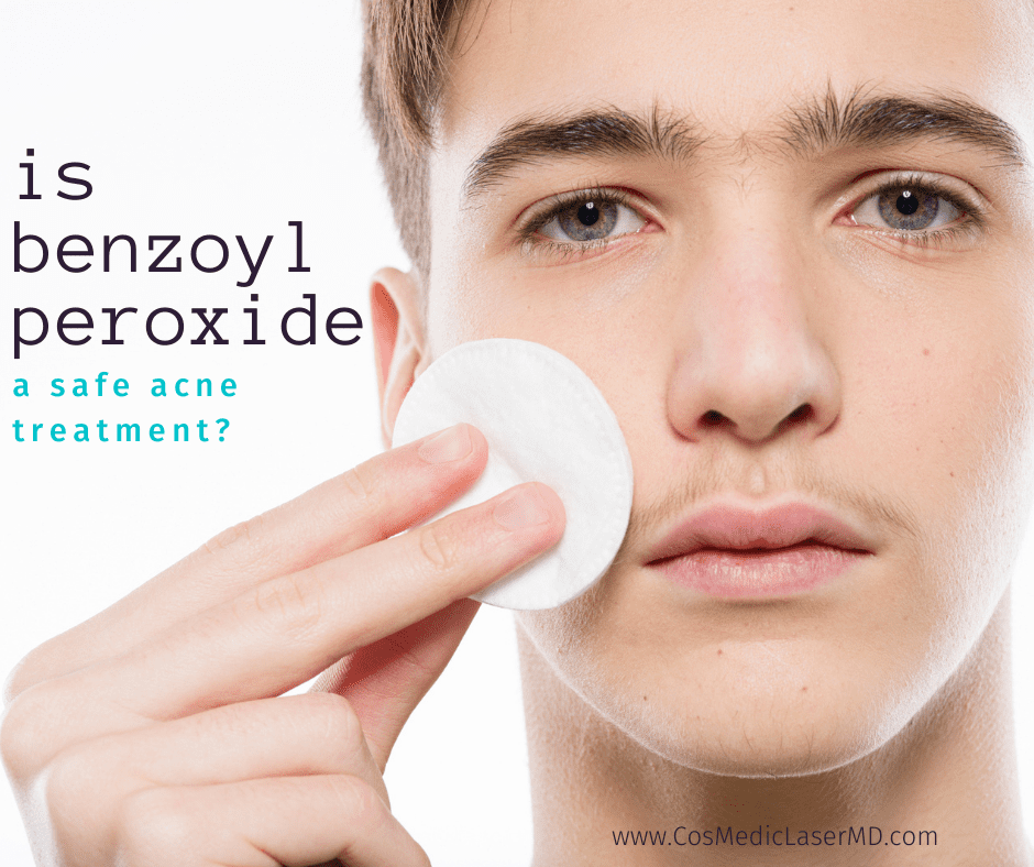 Is Benzoyl Peroxide Safe for Acne Treatment?