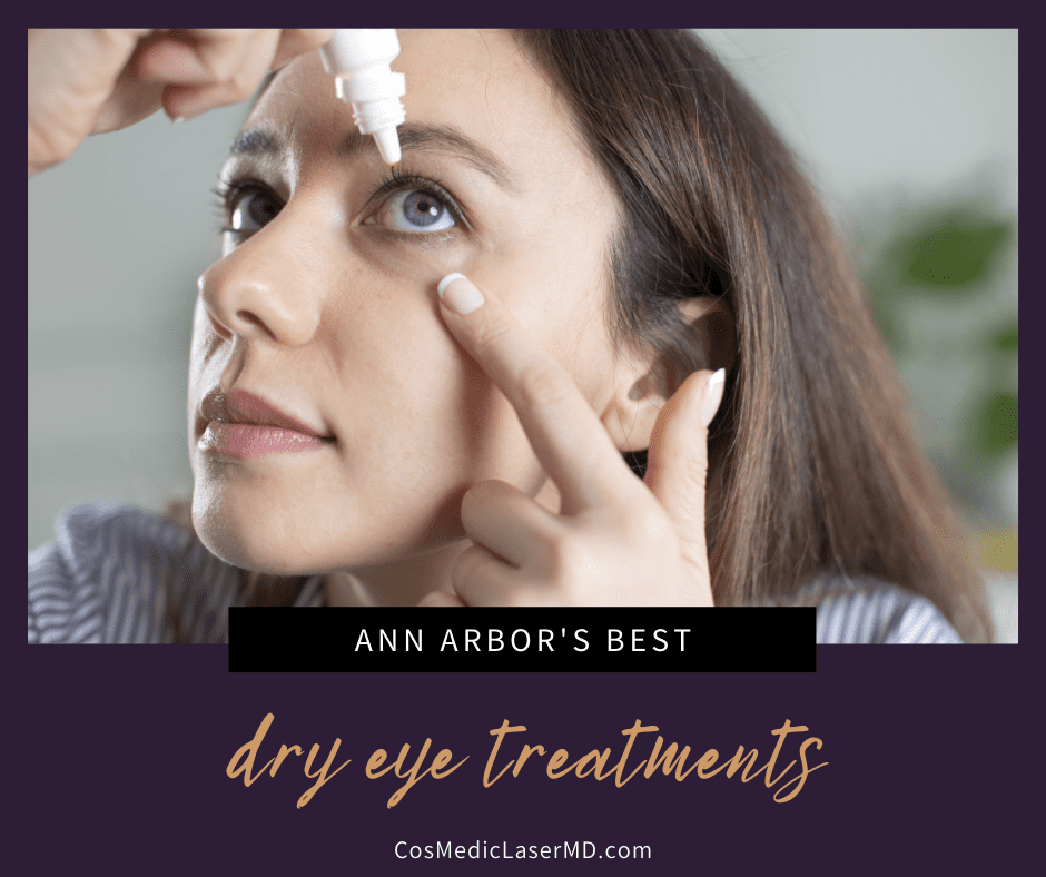 The Best Dry Eye Treatments in Ann Arbor