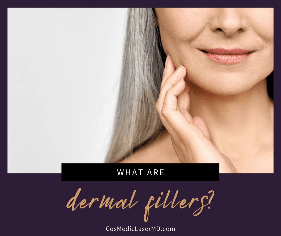 What Are Dermal Fillers?