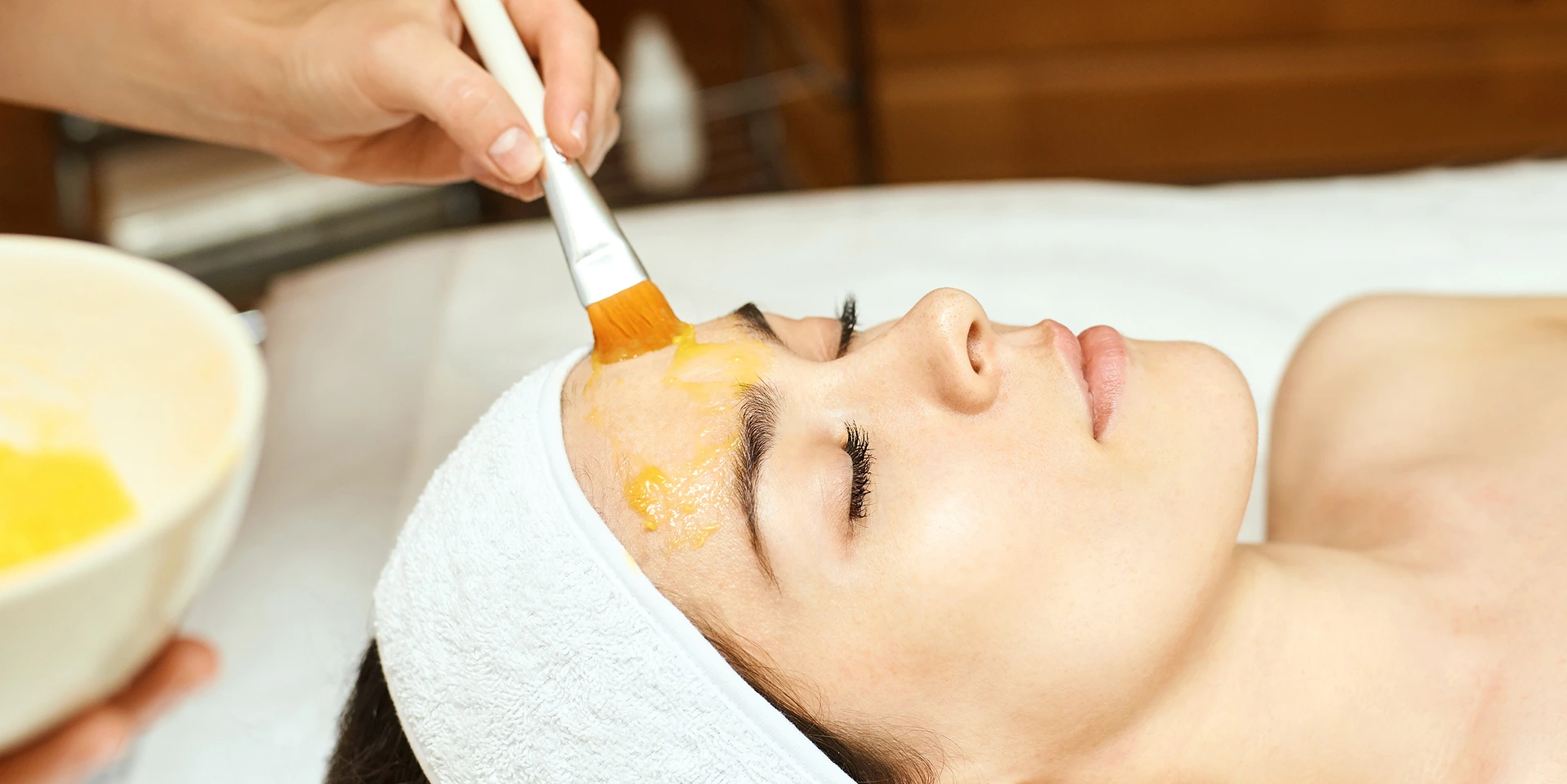 How Much Does a Chemical Peel Cost?