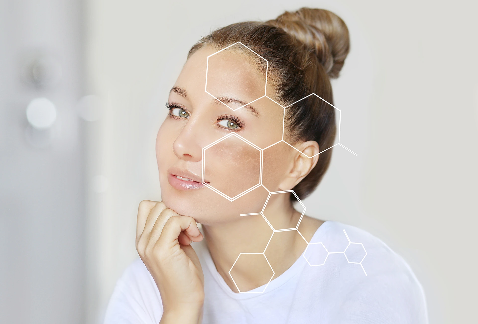 Chemical Peel for Hyperpigmentation
