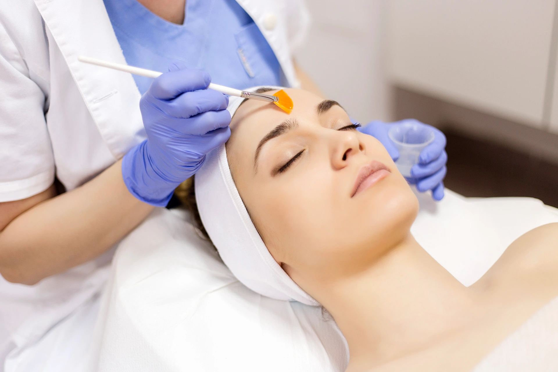 Chemical Peel After Botox