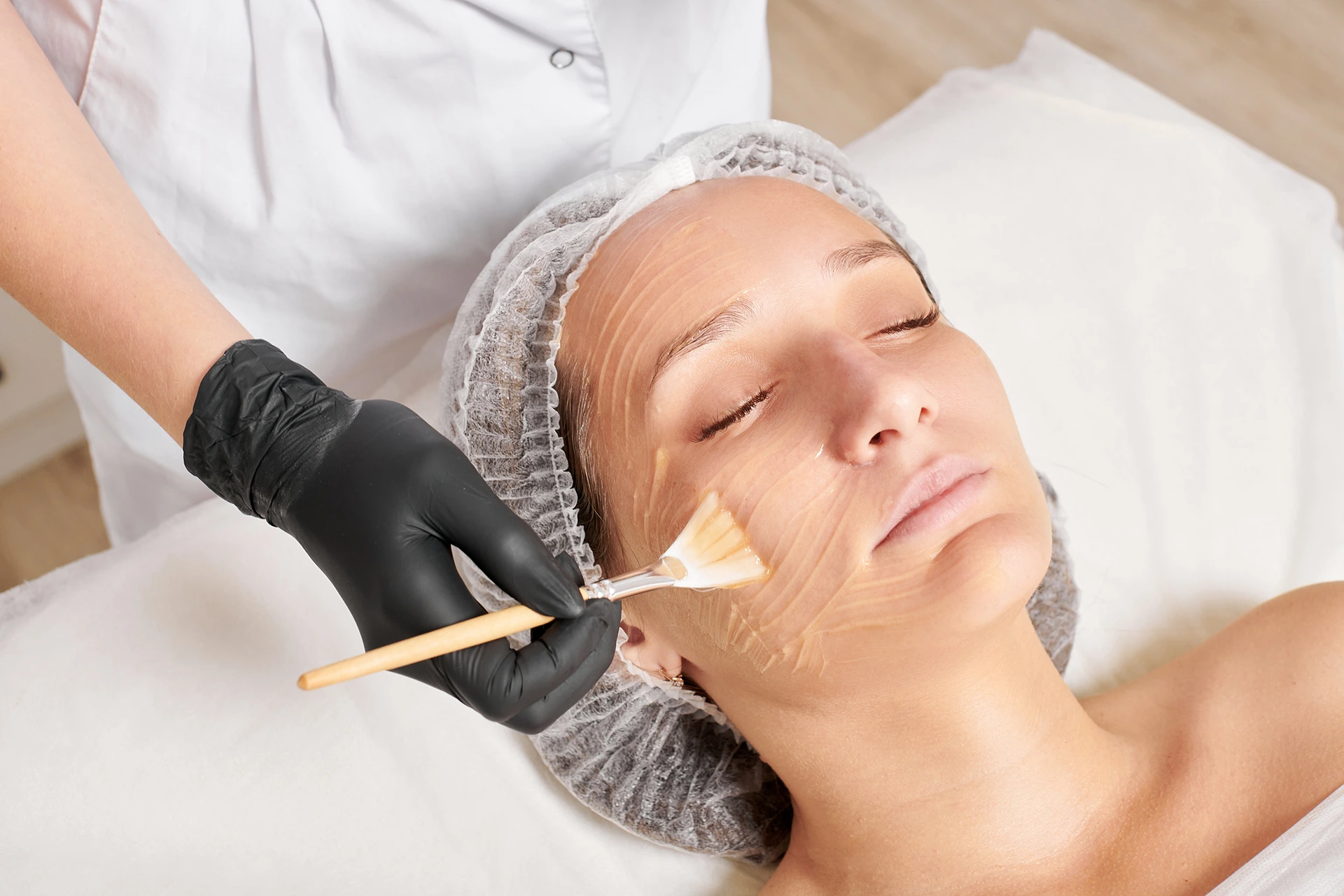 Why Does My Skin Peel After a Sunburn?