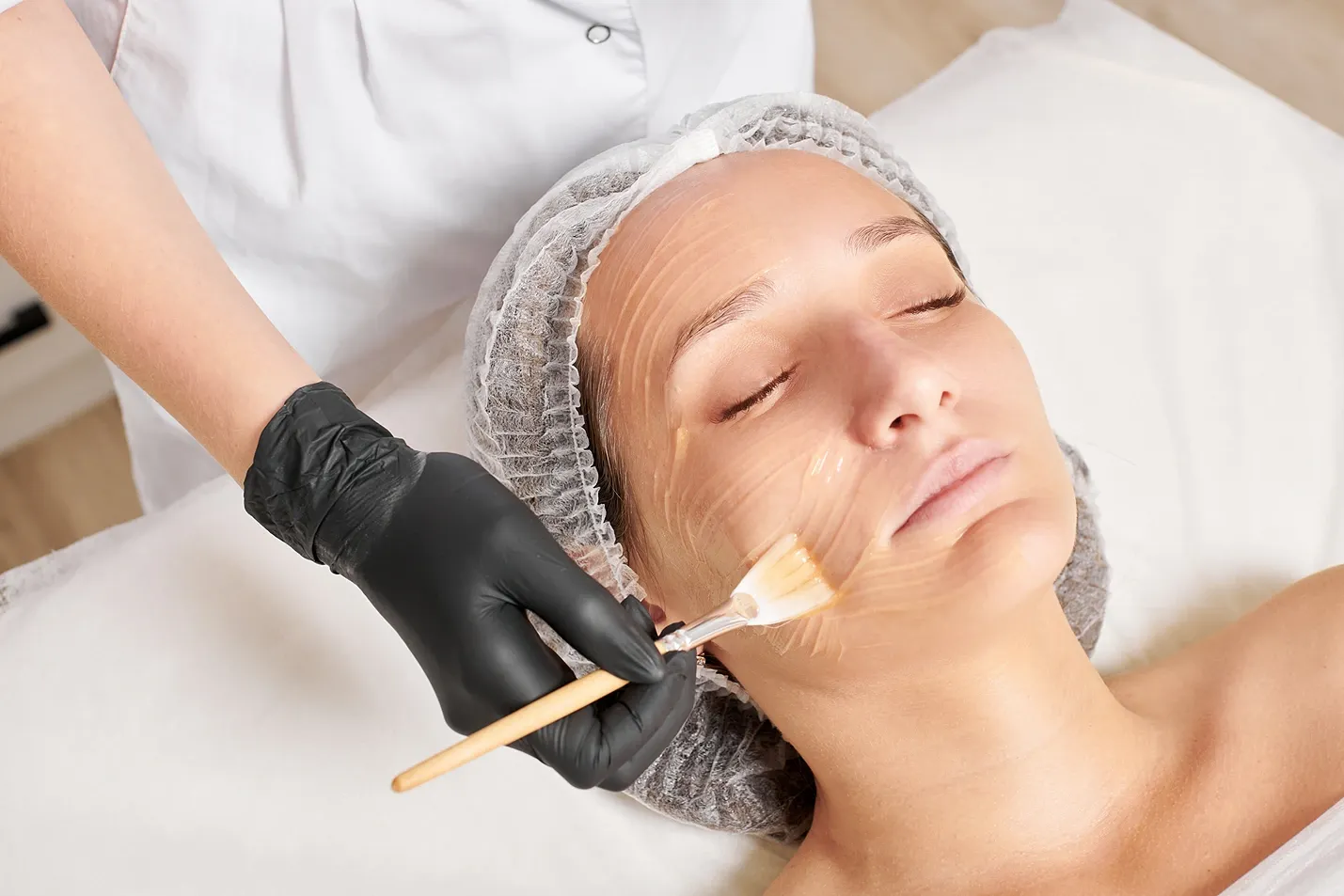 Why Isn't My Chemical Peel Peeling?