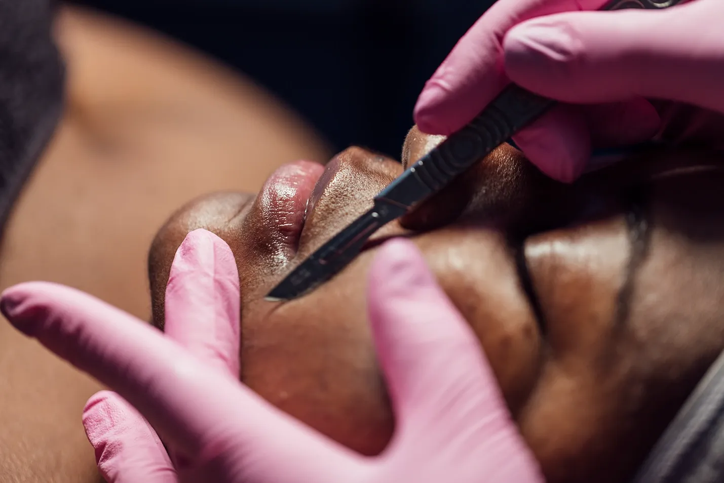 Dermablading vs Dermaplaning: The Ultimate Guide to Facial Exfoliation