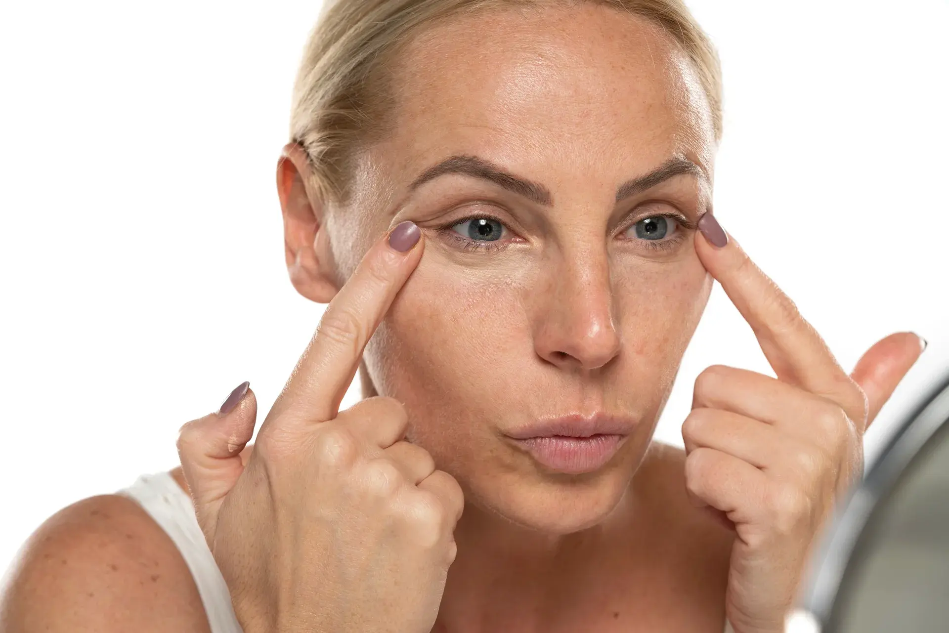 Under Eye Chemical Peels in Ann Arbor