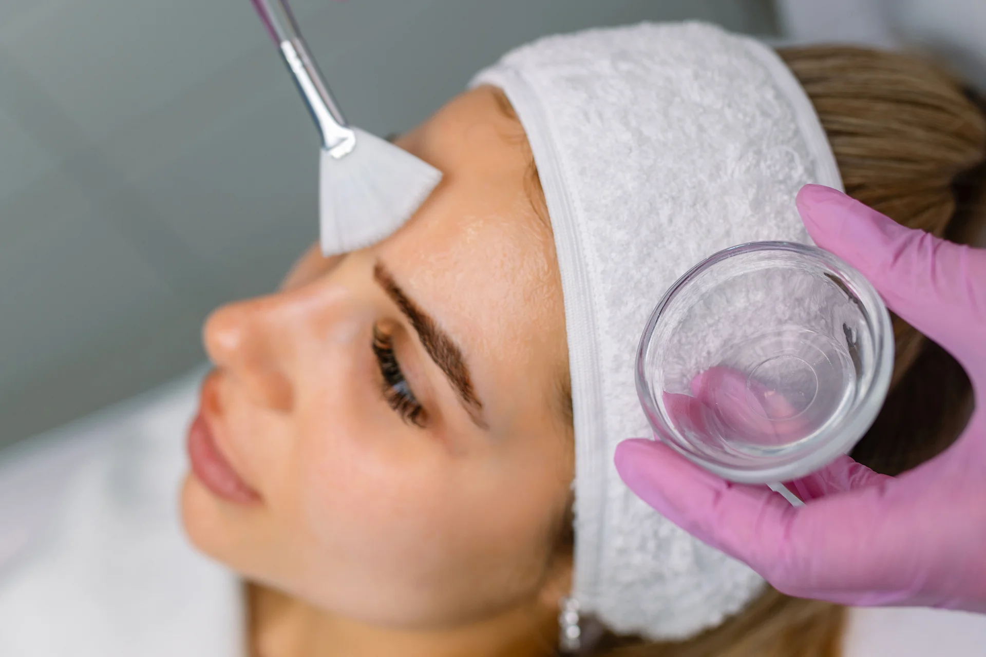 Managing Itchy Bumps After Chemical Peels