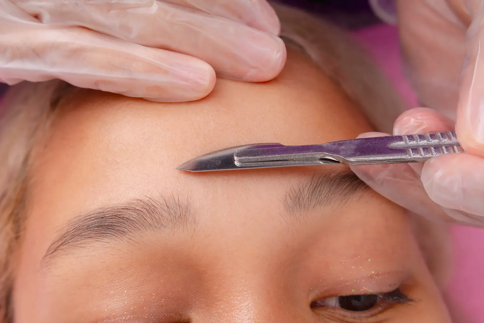 Dermaplaning vs Threading: Which Facial Hair Removal Method Is Right for You?