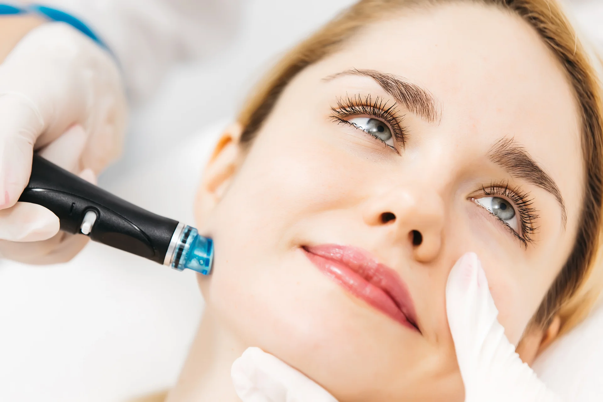 Post-Winter Hydration: Why Saline Residents Are Switching to Medical-Grade Facials