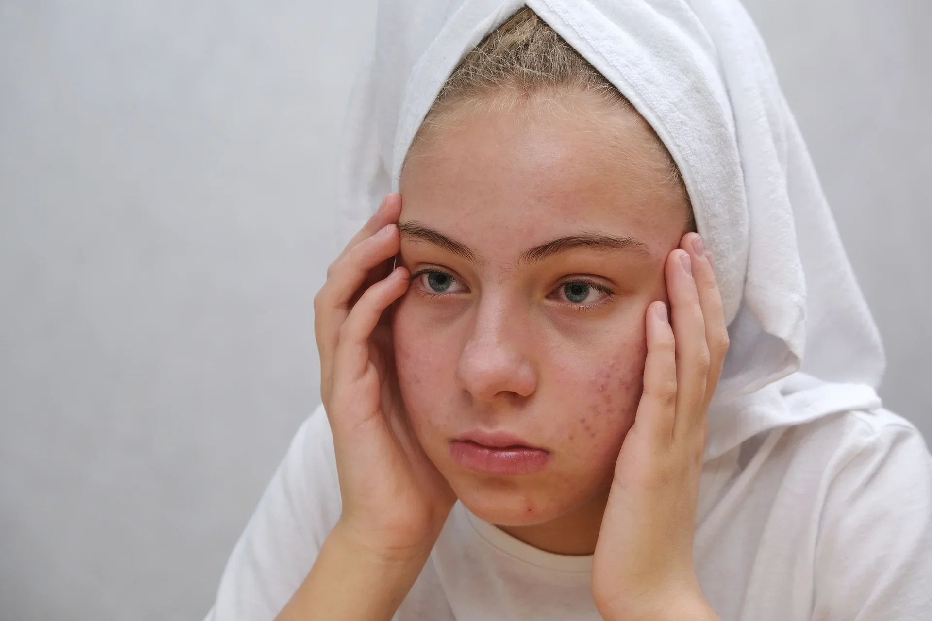 The "Glow Up" Timeline: Planning Your Skincare for Ann Arbor’s Prom Season