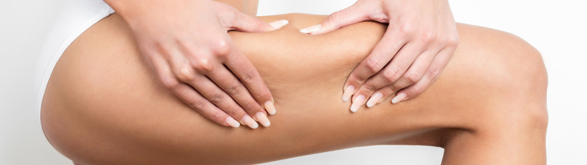 Cellulite