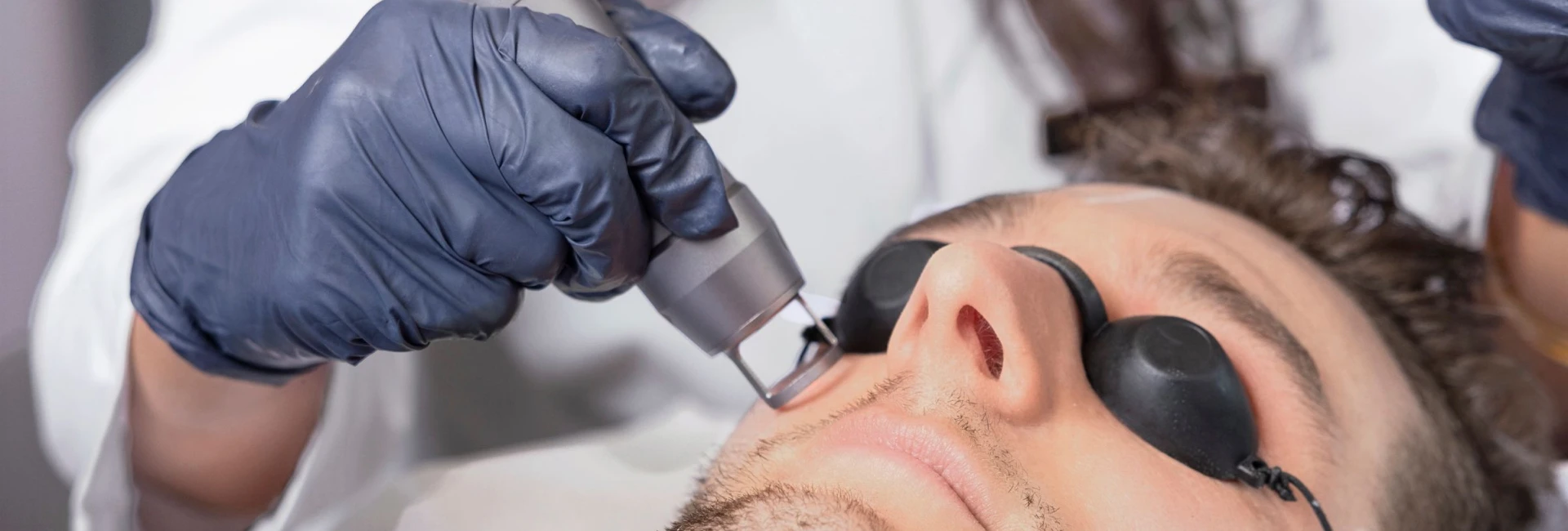 PicoLazer Tattoo Removal
