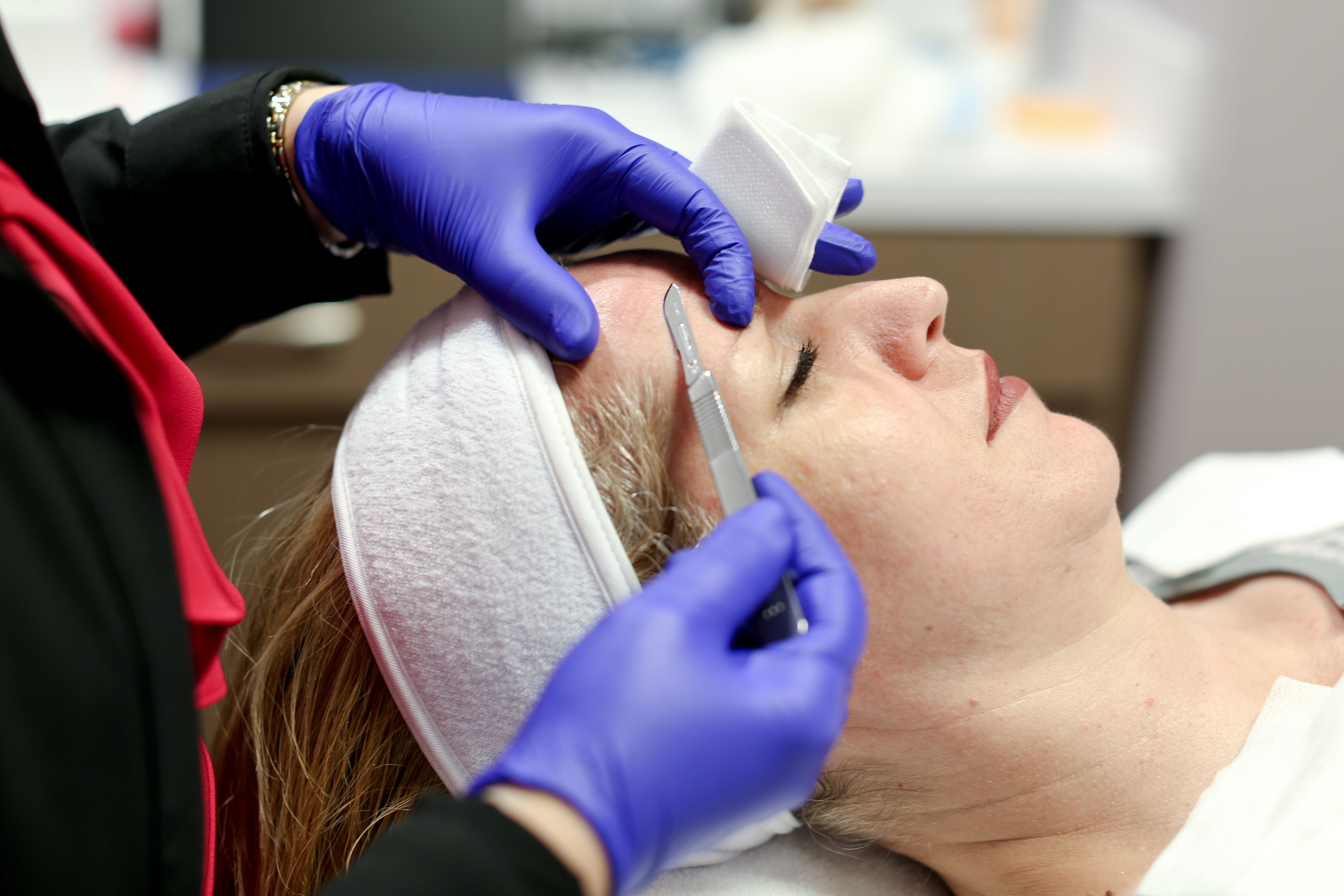 Dermaplaning treatment at CosMedic LaserMD in Ann Arbor, MI